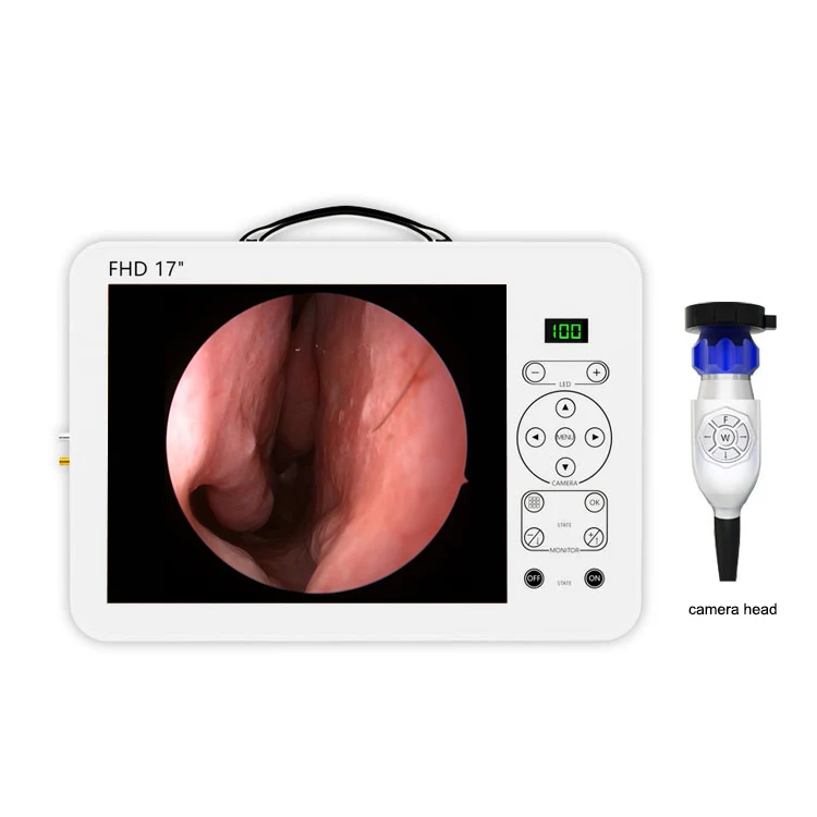 17 Zoll HD Video-Otoskop HNO-D – Medical Lab Images Bewertung und Preis