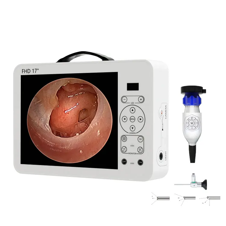 17 Zoll HD Video-Otoskop HNO-D – Medical Lab Images Bewertung und Preis